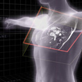 MRI